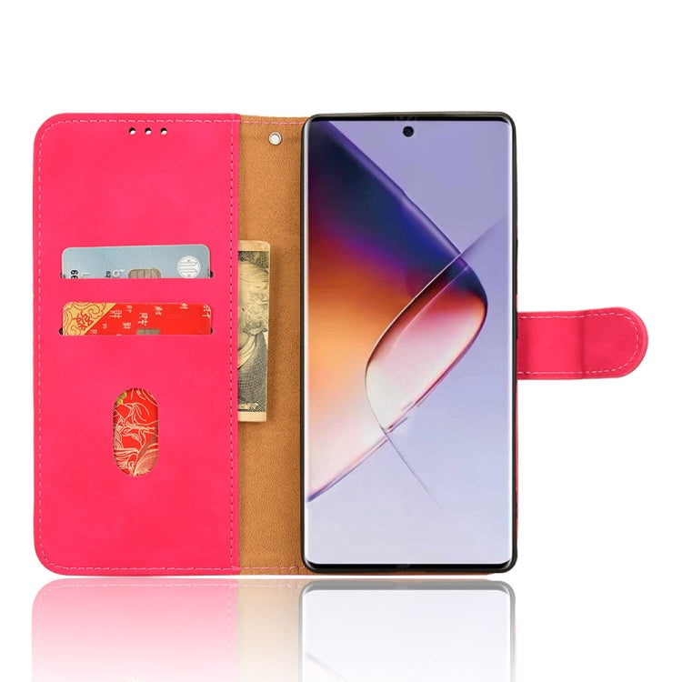 For Infinix Note 40 5G Skin Feel Magnetic Flip Leather Phone Case