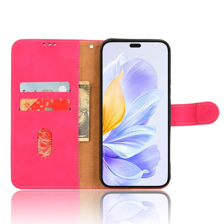 For Honor X60i 5G Skin Feel Magnetic Flip Leather Phone Case