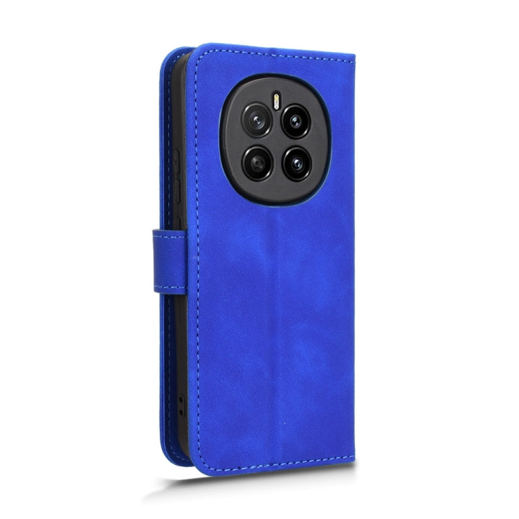 For Honor Magic7 Skin Feel Magnetic Flip Leather Phone Case