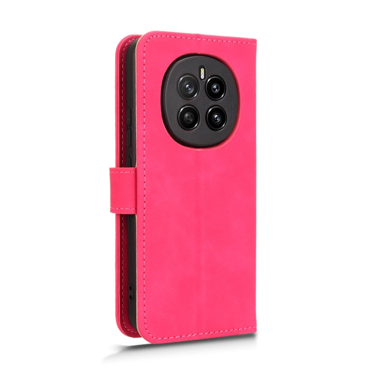 For Honor Magic7 Skin Feel Magnetic Flip Leather Phone Case
