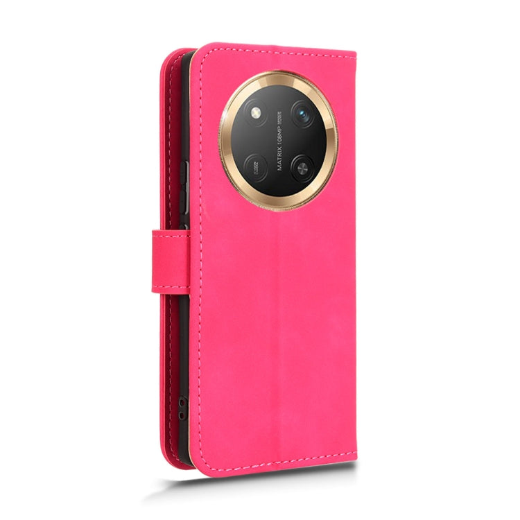 For Honor X60 Pro 5G / X9c 5G Skin Feel Magnetic Flip Leather Phone Case