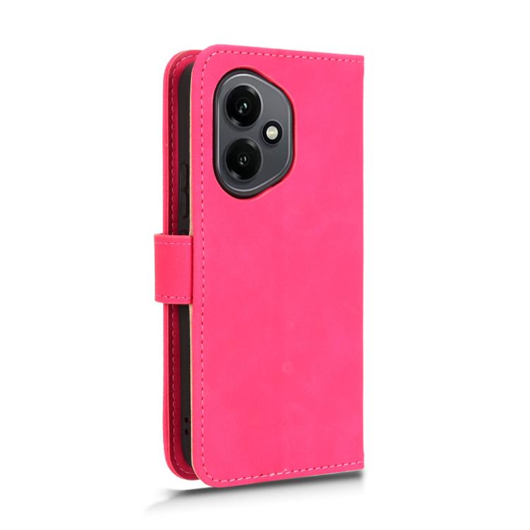 For Honor 400 Global 156.5mm Skin Feel Magnetic Flip Leather Phone Case