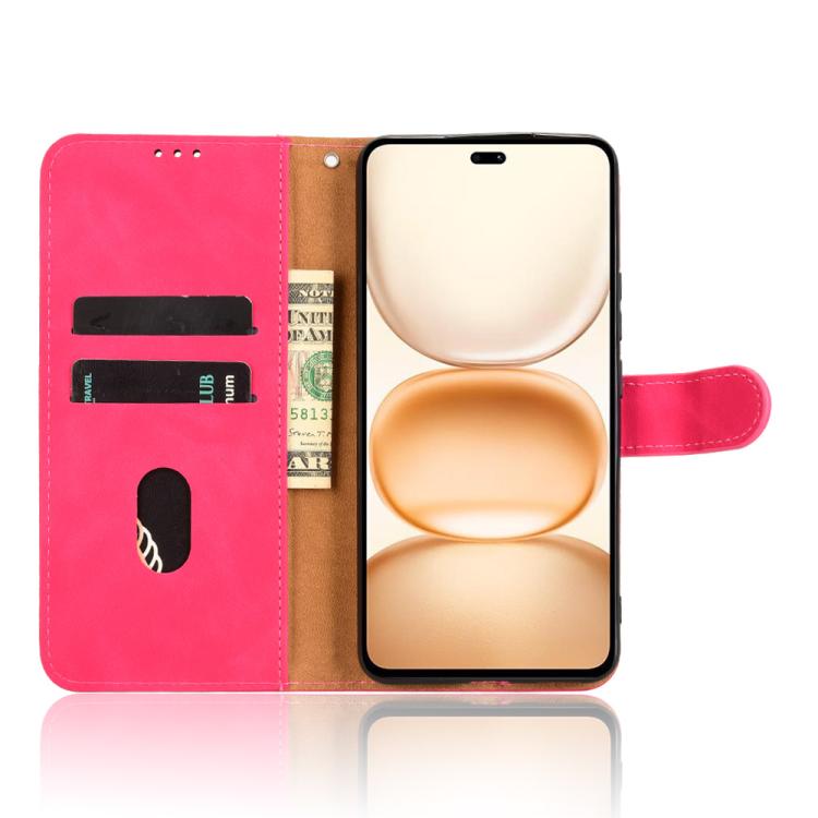 For Honor Power 5G Skin Feel Magnetic Flip Leather Phone Case