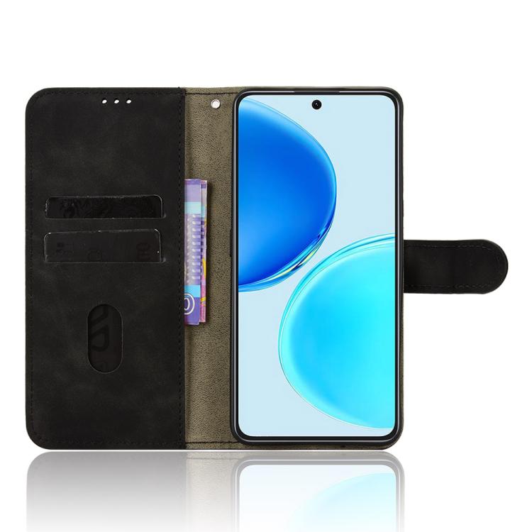 For Honor X8d 4G Skin Feel Magnetic Flip Leather Phone Case