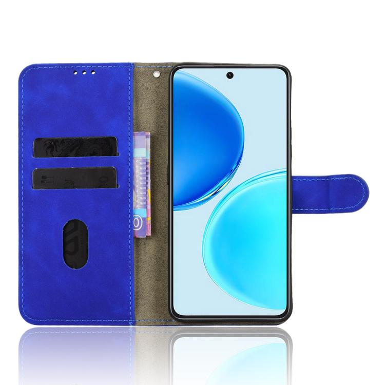 For Honor X8d 4G Skin Feel Magnetic Flip Leather Phone Case