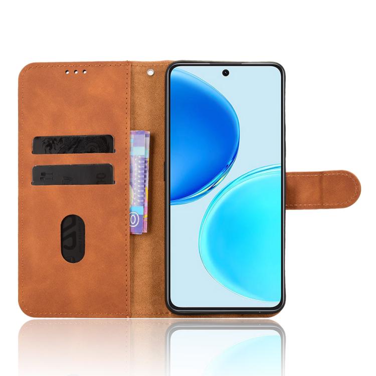 For Honor X8d 4G Skin Feel Magnetic Flip Leather Phone Case