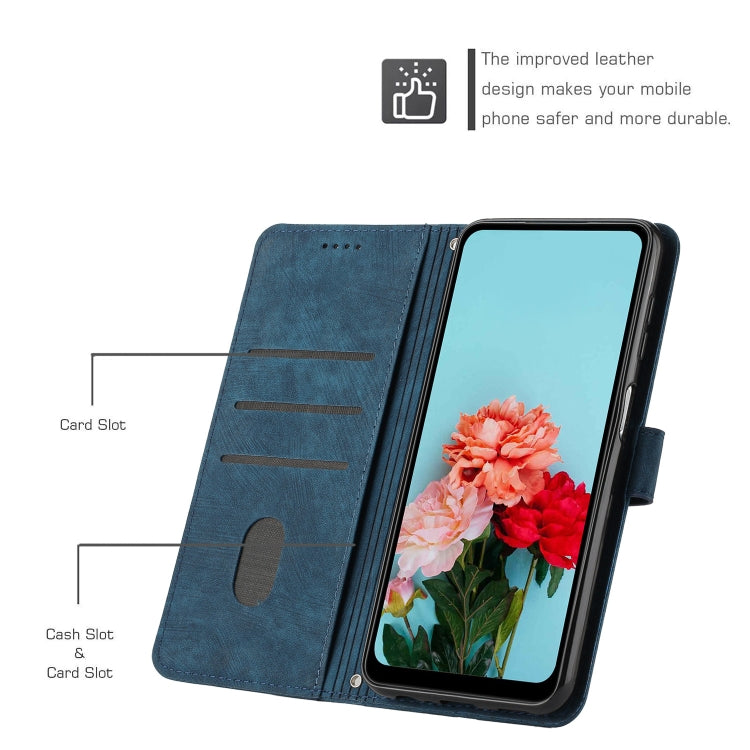 For OPPO A3 Pro Skin Feel Stripe Pattern Leather Phone Case with Lanyard