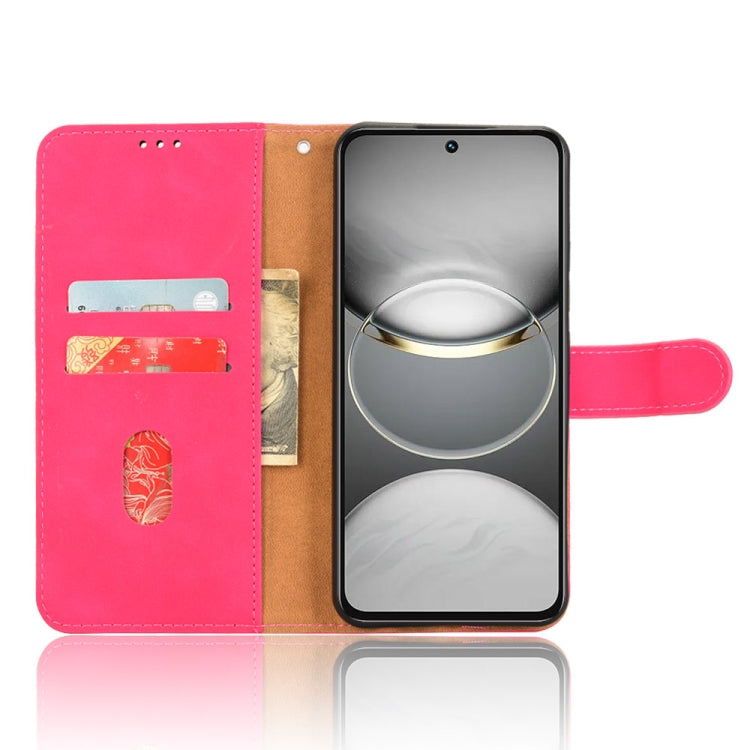 For Tecno Spark 30 Pro 4G Skin Feel Magnetic Flip Leather Phone Case