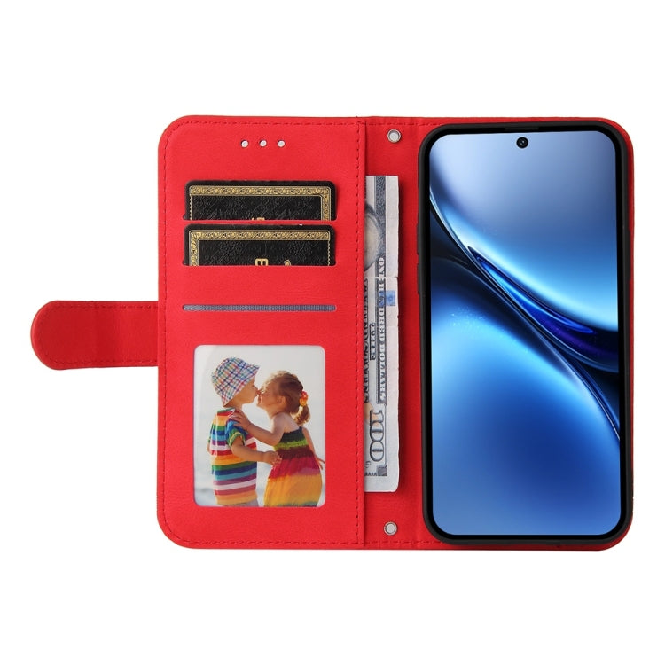For vivo X200 Skin Feel Life Tree Metal Button Leather Phone Case