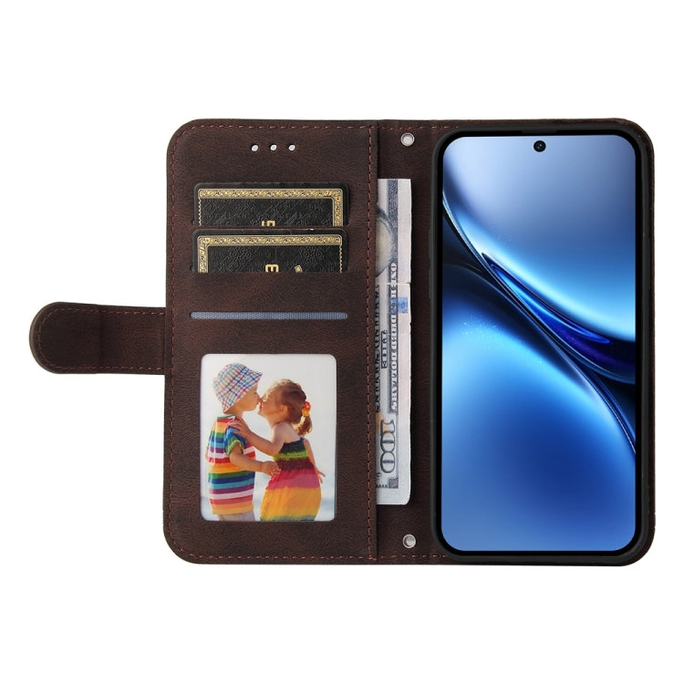 For vivo X200 Skin Feel Life Tree Metal Button Leather Phone Case