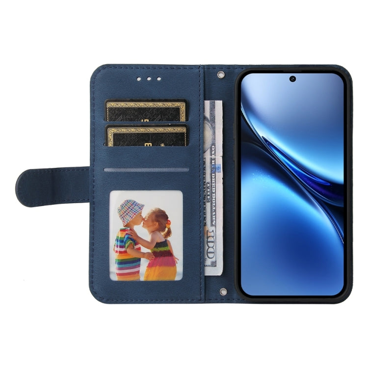 For vivo X200 Skin Feel Life Tree Metal Button Leather Phone Case