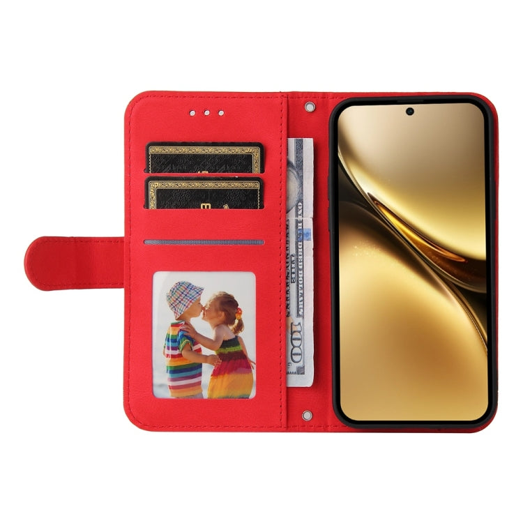 For vivo X200 Pro Skin Feel Life Tree Metal Button Leather Phone Case