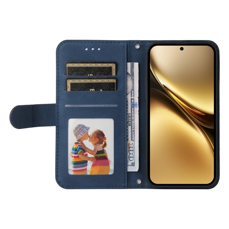 For vivo X200 Pro Skin Feel Life Tree Metal Button Leather Phone Case