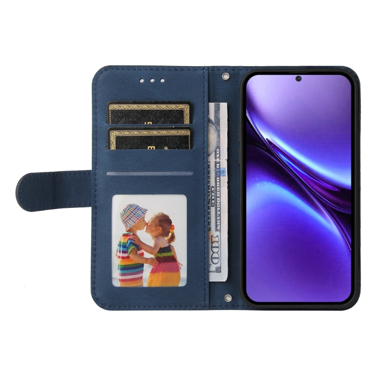 For vivo X200 Pro mini Skin Feel Life Tree Metal Button Leather Phone Case