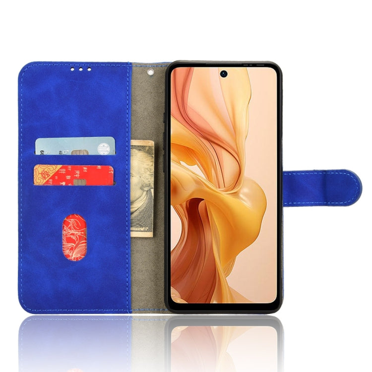 For Ulefone Note 18 Ultra Skin Feel Magnetic Flip Leather Phone Case