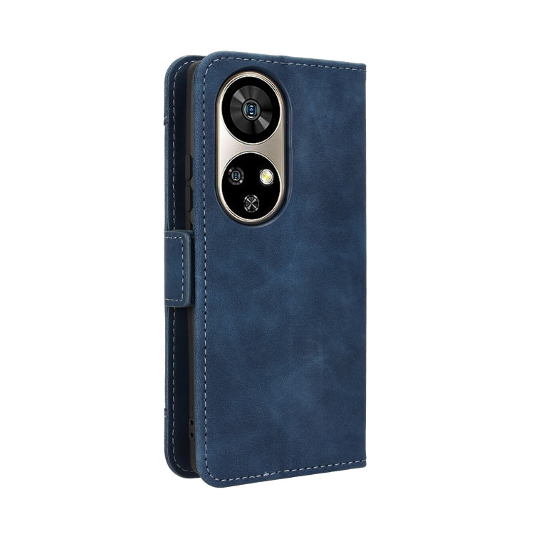 For Ulefone Note 17 Pro Skin Feel Calf Texture Card Slots Leather Phone Case
