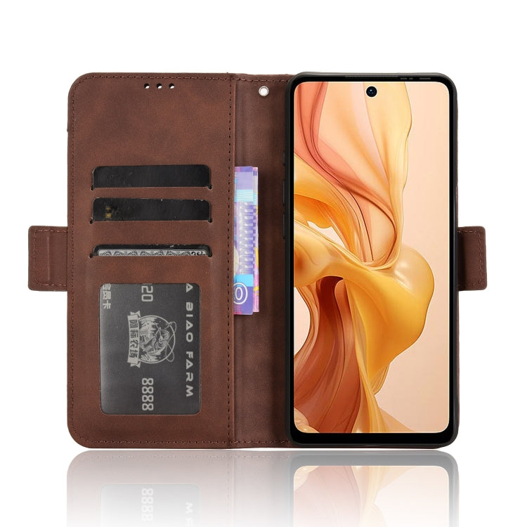 For Ulefone Note 18 Ultra Skin Feel Calf Texture Card Slots Leather Phone Case