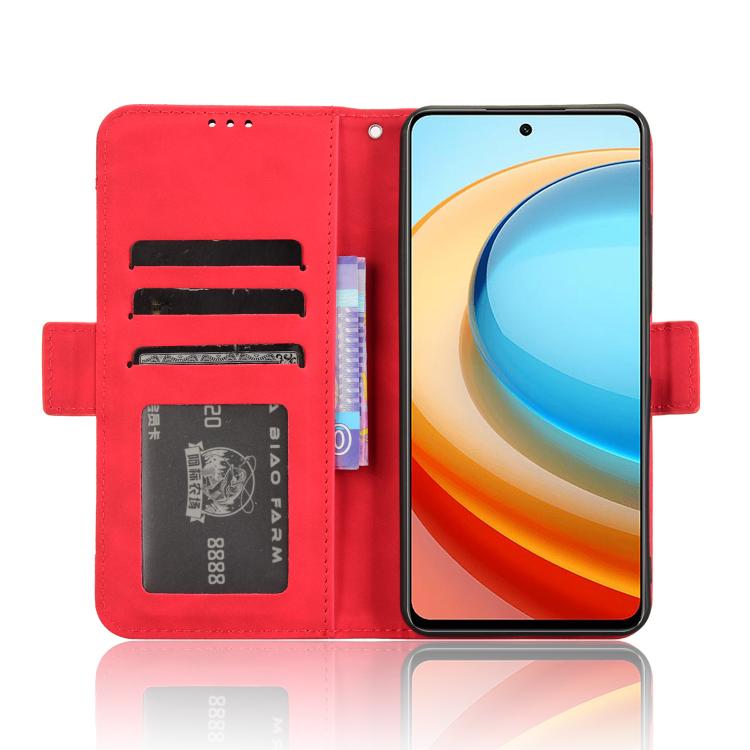 For ZTE Blade A75 5G Skin Feel Calf Texture Card Slots Leather Phone Case