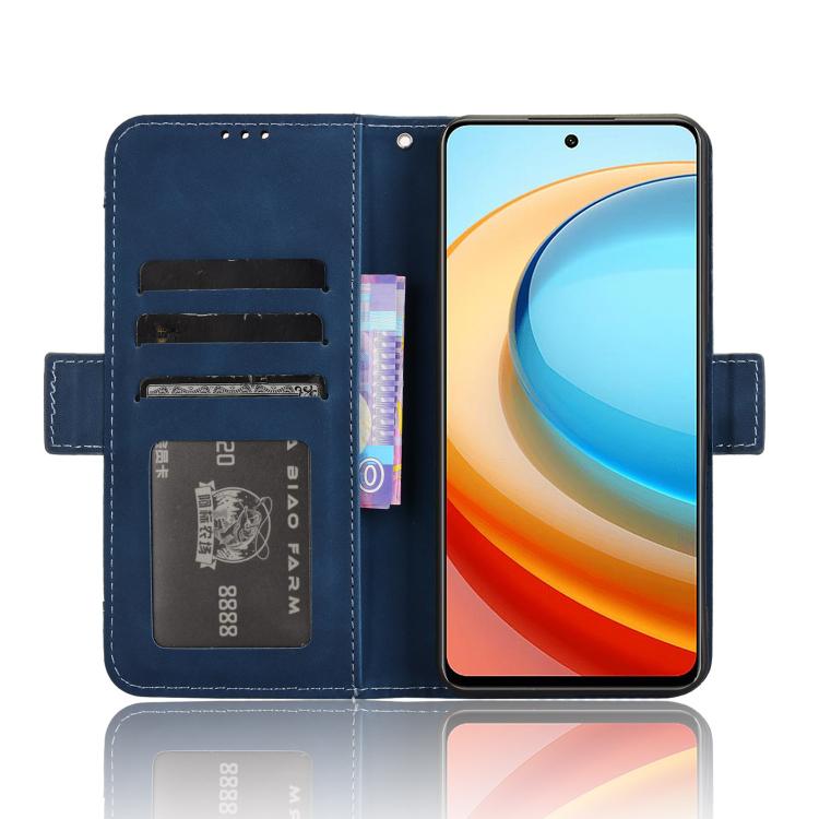 For ZTE Blade A75 5G Skin Feel Calf Texture Card Slots Leather Phone Case