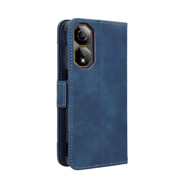 For ZTE nubia Neo 2 Skin Feel Calf Texture Card Slots Leather Phone Case