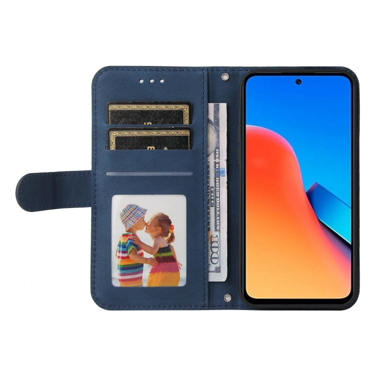 For Xiaomi Redmi 12 4G Skin Feel Life Tree Metal Button Leather Phone Case