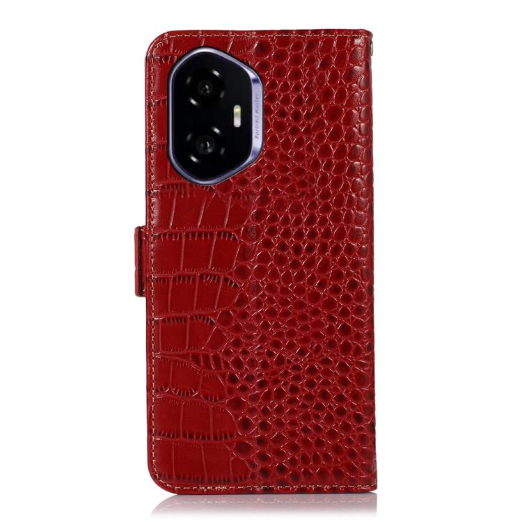 For Honor 400 Global 156.5mm Crocodile Top Layer Cowhide Leather Phone Case