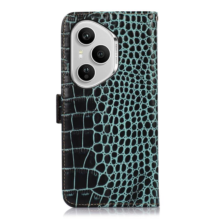 For Honor 400 Pro Global 160.8mm Crocodile Top Layer Cowhide Leather Phone Case