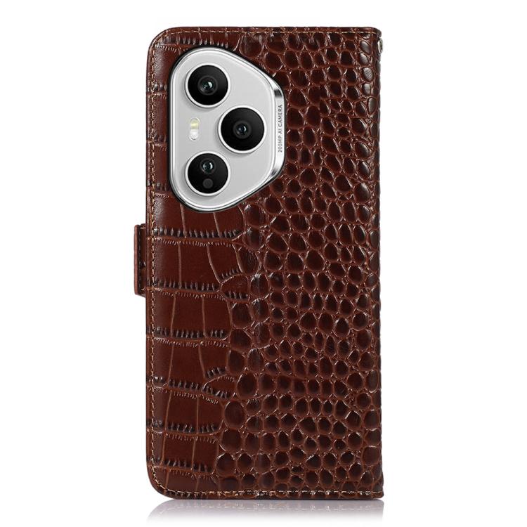 For Honor 400 Pro Global 160.8mm Crocodile Top Layer Cowhide Leather Phone Case