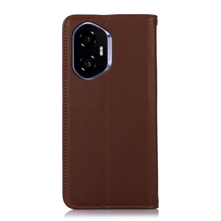 For Honor 400 Global 156.5mm KHAZNEH Nappa Top Layer Cowhide Leather Phone Case