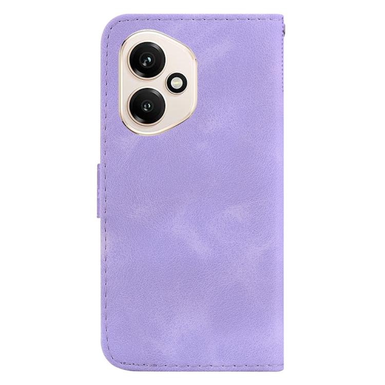 For Honor 400 Global 156.5mm Seven-shaped Embossed Leather Phone Case