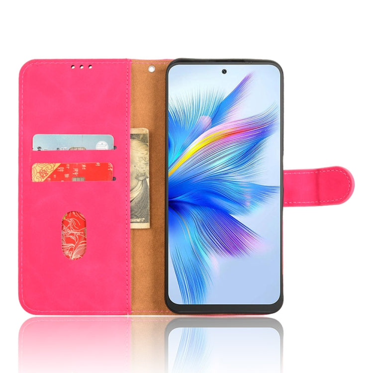 For Blackview Shark 9 5G Skin Feel Magnetic Flip Leather Phone Case