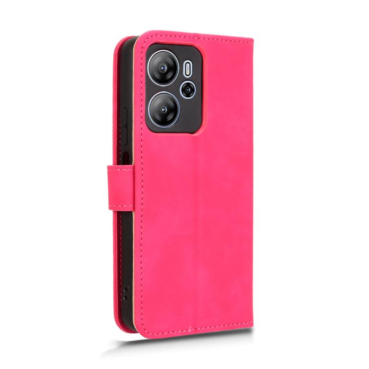 For Blackview Oscal Tiger 13 Skin Feel Magnetic Flip Leather Phone Case