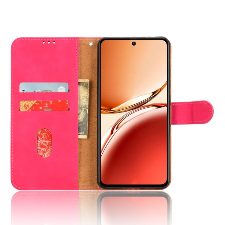 For OPPO Reno12 F 5G Skin Feel Magnetic Flip Leather Phone Case