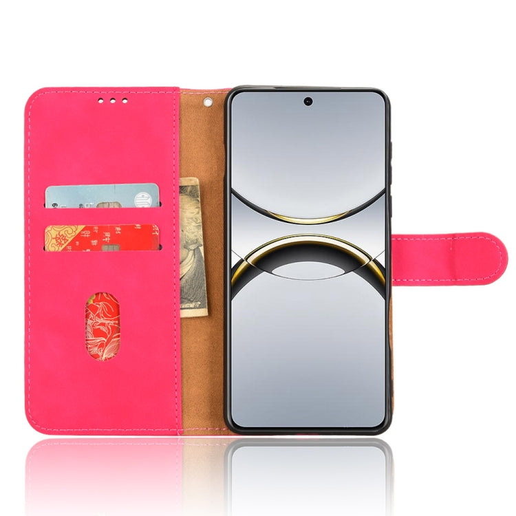 For OPPO Find X8 Pro Skin Feel Magnetic Flip Leather Phone Case