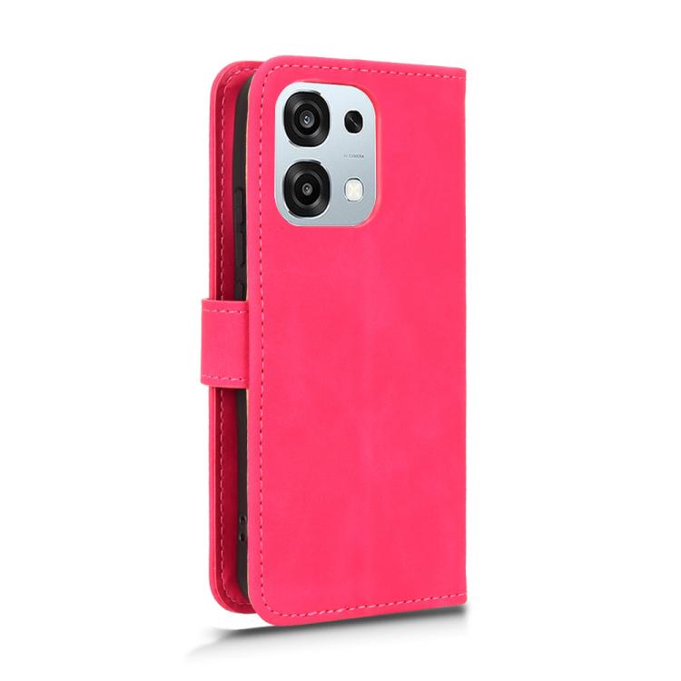 For OPPO A6 Pro 4G / 5G Global Skin Feel Magnetic Flip Leather Phone Case