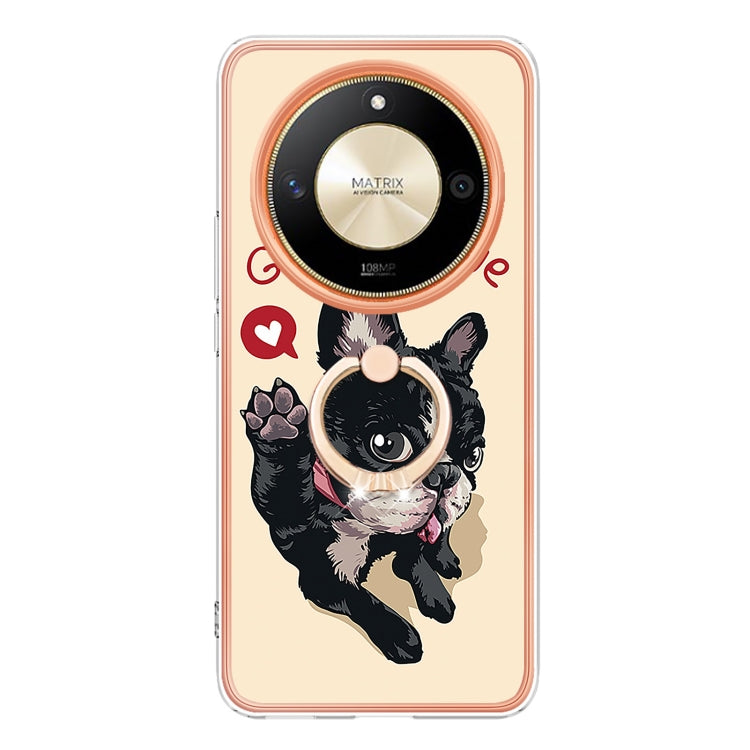 For Honor X9b Electroplating Dual-side IMD Phone Case with Ring Holder