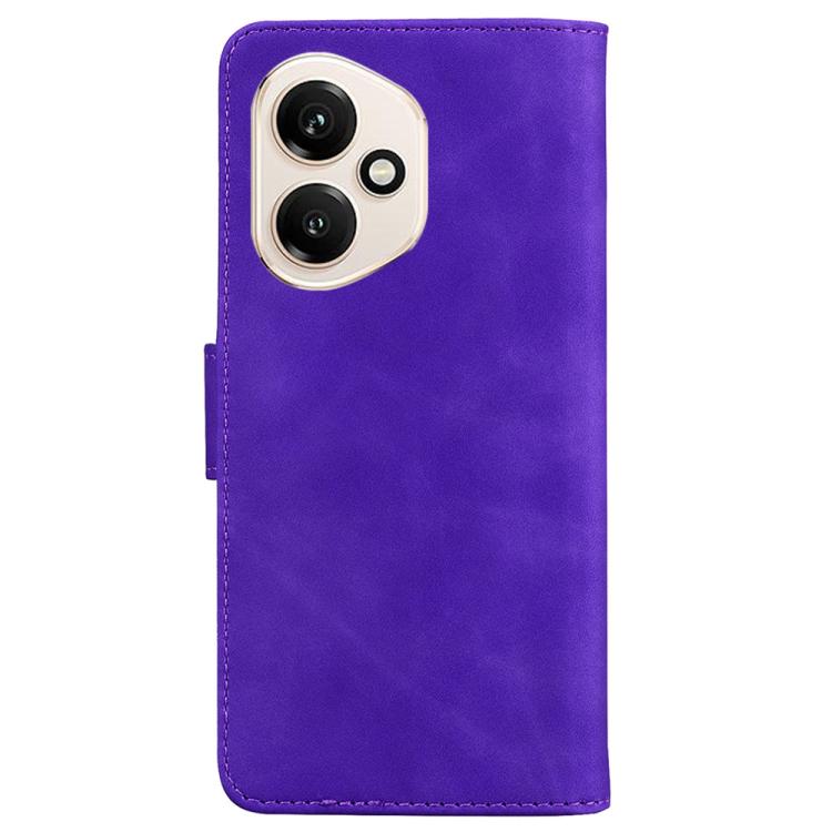 For Honor 400 Global 156.5mm Skin Feel Pure Color Flip Leather Phone Case