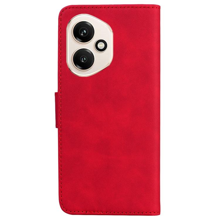 For Honor 400 Global 156.5mm Skin Feel Pure Color Flip Leather Phone Case