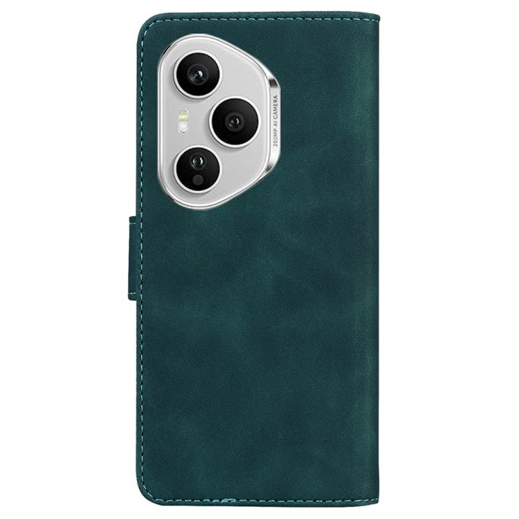 For Honor 400 Pro Global 160.8mm Skin Feel Pure Color Flip Leather Phone Case