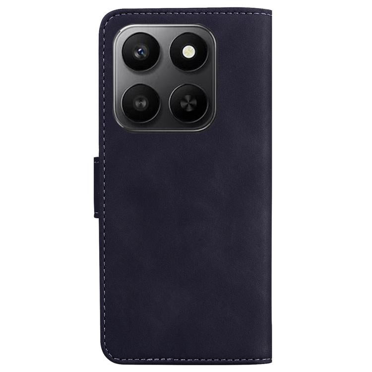 For Honor 400 Smart 4G / 5G Skin Feel Pure Color Flip Leather Phone Case
