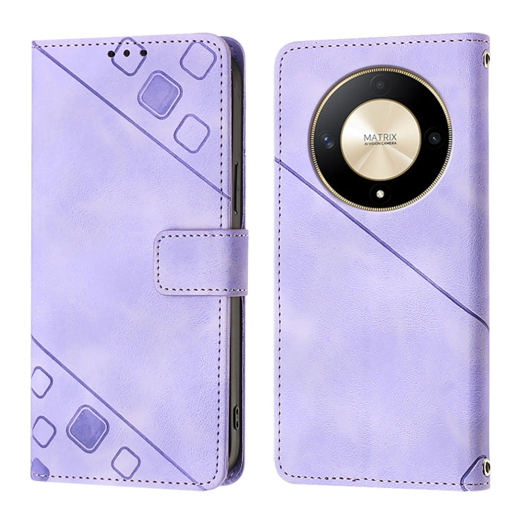 For Honor X9b / Magic6 Lite 5G Global Skin-feel Embossed Leather Phone Case