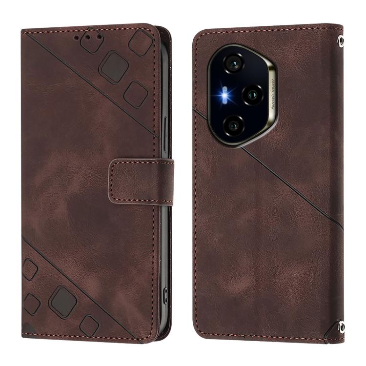 For Honor 400 Global 156.5mm Skin-feel Embossed Leather Phone Case