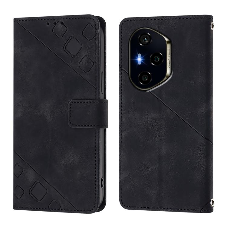 For Honor 400 Global 156.5mm Skin-feel Embossed Leather Phone Case