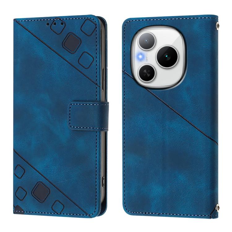 For Honor Power 5G Skin-feel Embossed Leather Phone Case