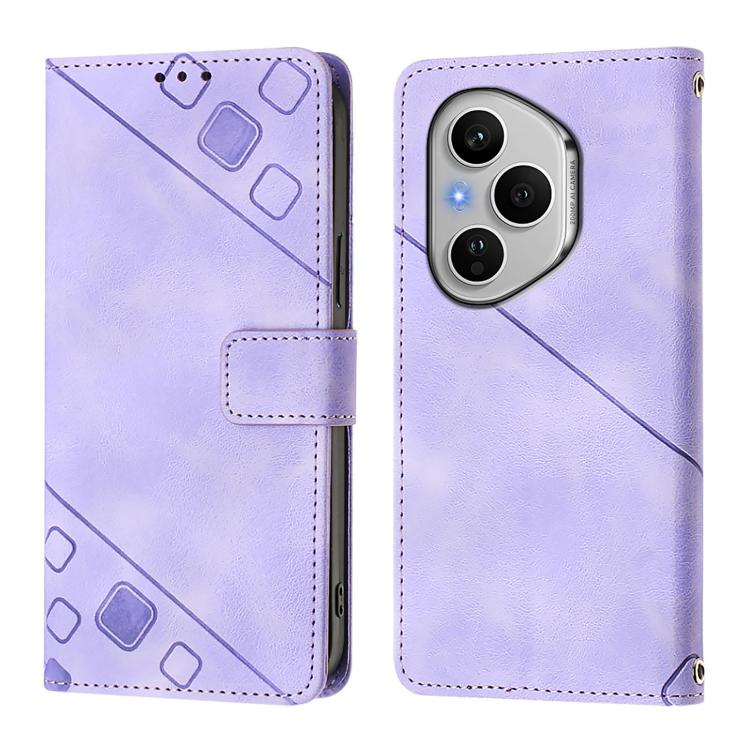 For Honor 400 Pro 5G Global 160.8mm Skin-feel Embossed Leather Phone Case