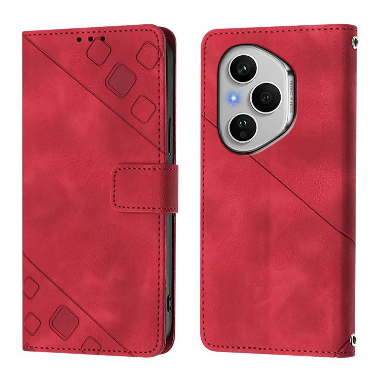 For Honor 400 Pro 5G Global 160.8mm Skin-feel Embossed Leather Phone Case