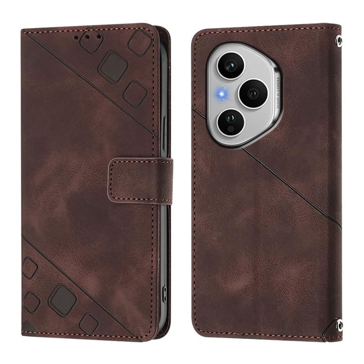 For Honor 400 Pro 5G Global 160.8mm Skin-feel Embossed Leather Phone Case