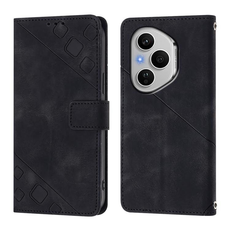 For Honor 400 Pro 5G Global 160.8mm Skin-feel Embossed Leather Phone Case