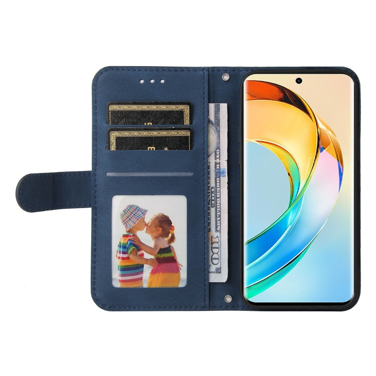 For Honor X50 Skin Feel Life Tree Metal Button Leather Phone Case