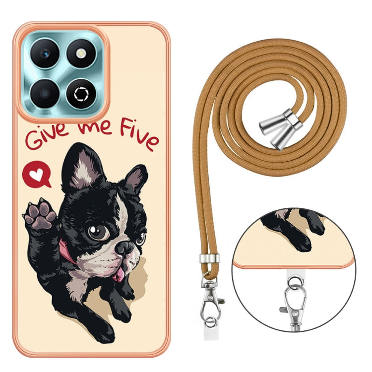 For Honor X6b Electroplating Dual-side IMD Phone Case with Lanyard